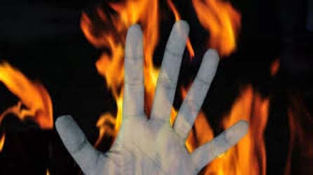 Fire breaks out in hotel converted into Kovid care center, 7 killed