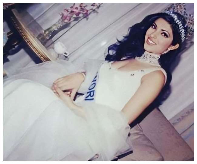 Priyanka Chopra was burnt before the Miss World 2000 event, said- someone gave me a push