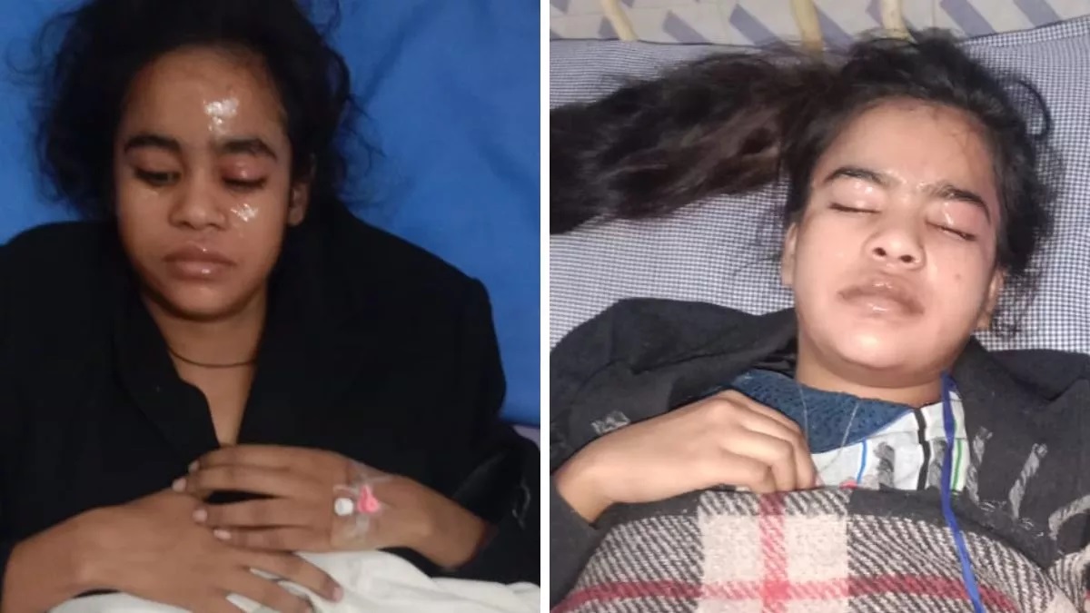 Acid thrown on real sisters during turmeric program, condition of both critical