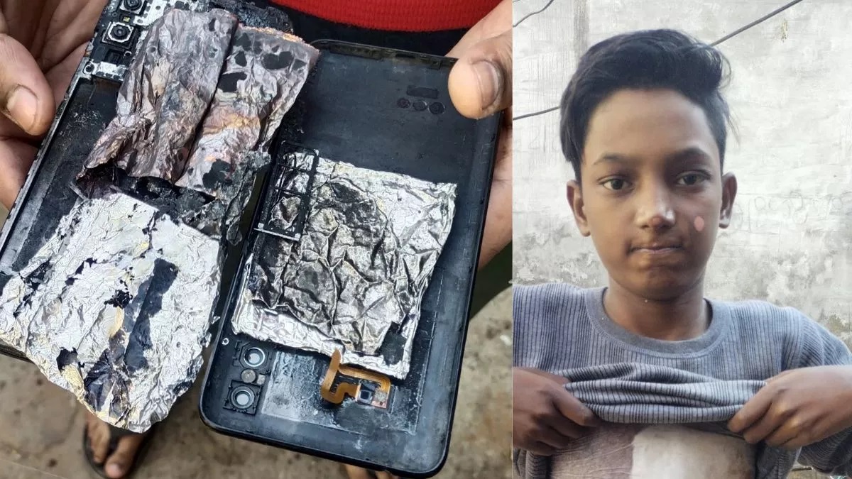 Mobile explodes while playing game in Mathura, innocent injured