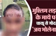 'Jai Bholenath' tattooed with a knife on the forehead of a Muslim boy, the perpetrator turns out to be a relative