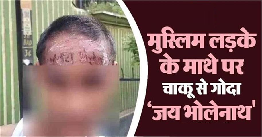 'Jai Bholenath' tattooed with a knife on the forehead of a Muslim boy, the perpetrator turns out to be a relative